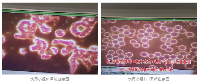 水蛭素、小蛭仙酒、酱香水蛭酒