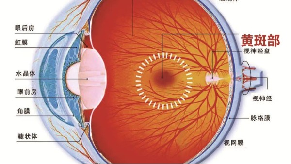 检查出老年相关性黄斑变性，或可用含水蛭方药治疗