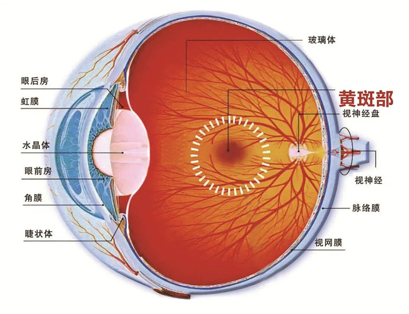 水蛭素、黄斑变性