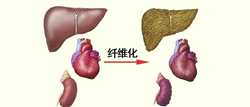 水蛭素、活血化瘀、纤维化