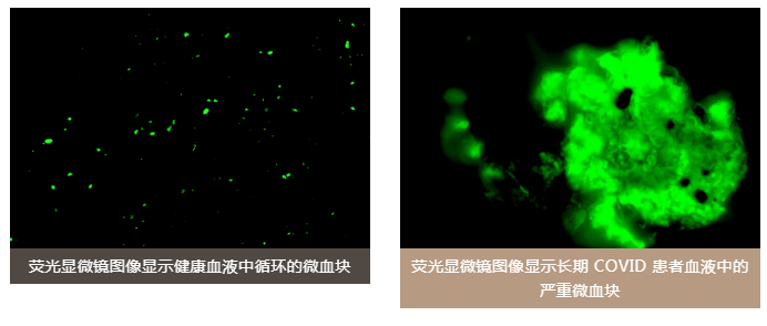 水蛭素、老年痴呆、前列腺、阳康