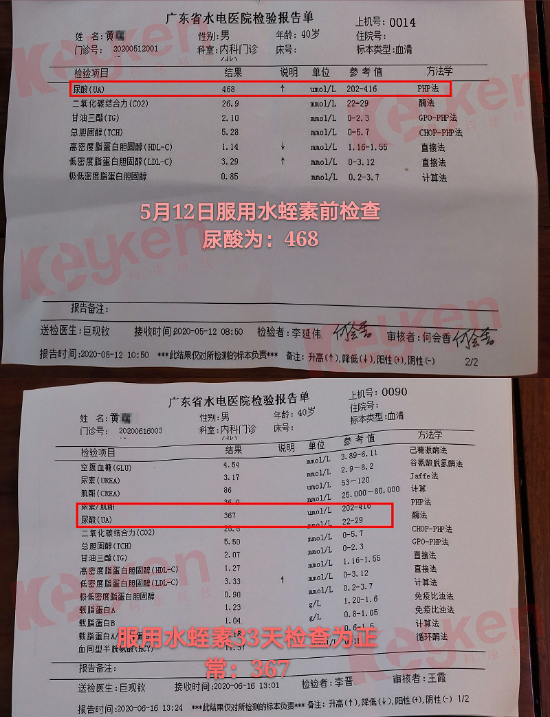 水蛭素、尿酸、痛风