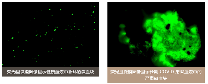 水蛭素、阳康、乌梅、壮医水蛭疗法