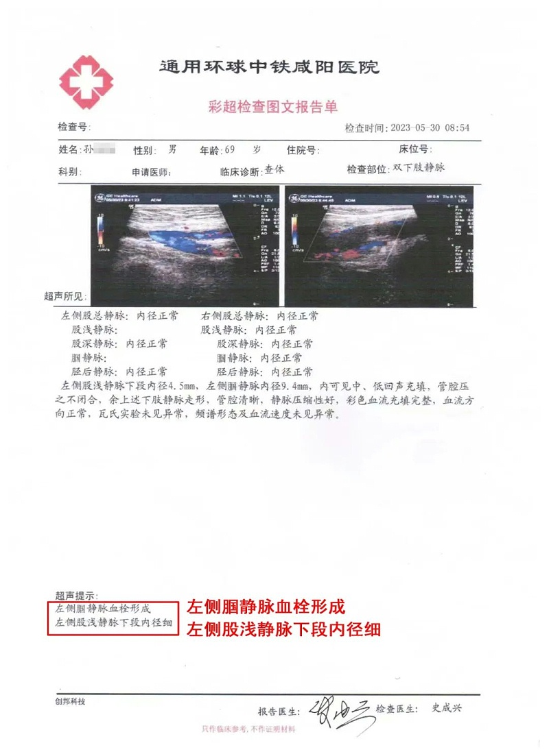 水蛭素、水蛭素胶囊、壮医水蛭疗法