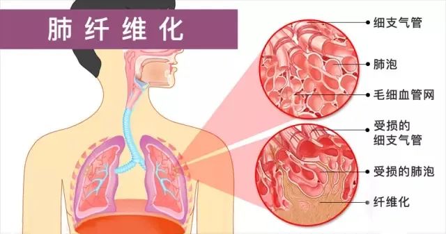 水蛭素、科康、旅游康养、壮医水蛭