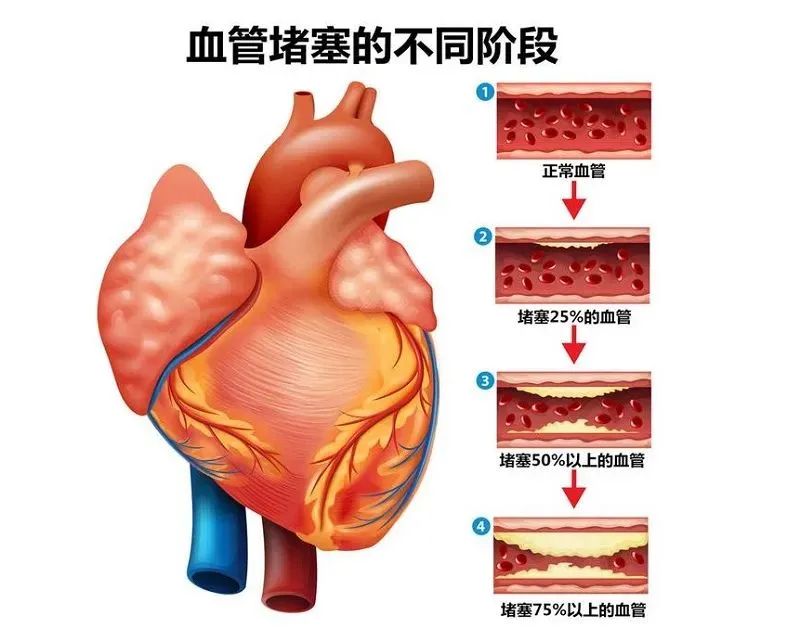 壮医水蛭疗法，天然水蛭素